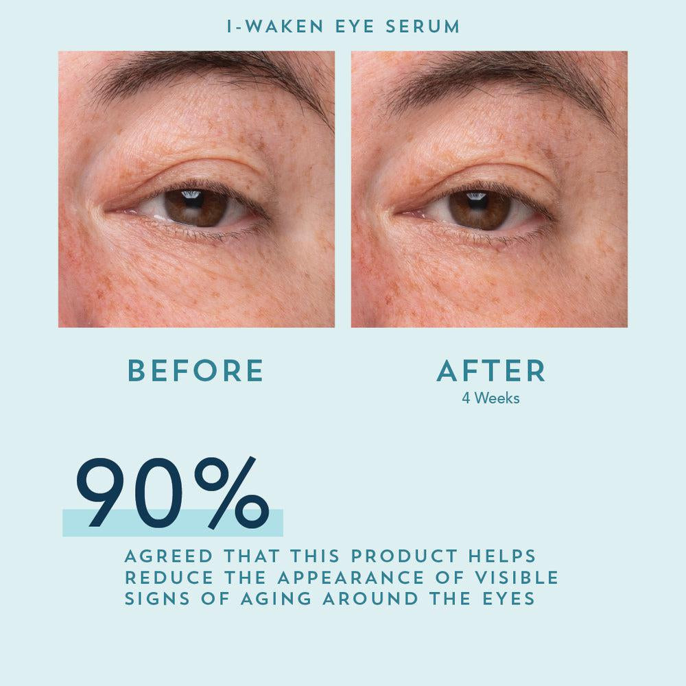 I-Waken Eye Serum – Sérum contour des yeux